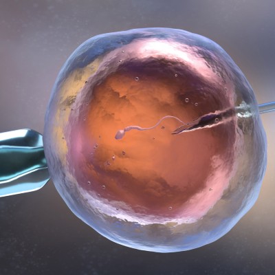 a single sperm for IVF