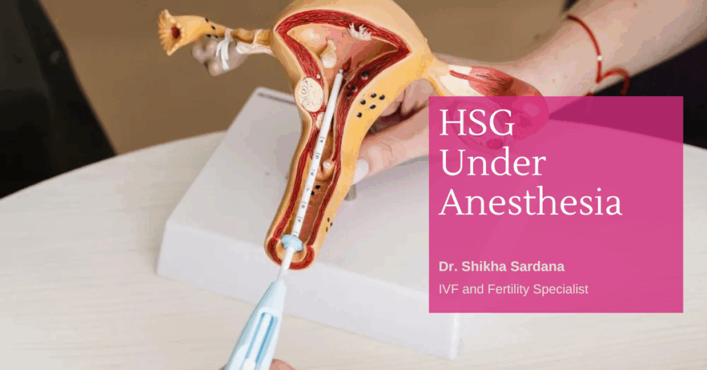 HSG Under Anesthesia